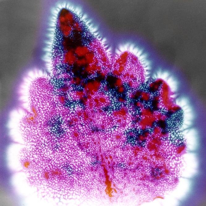 File:Kirlian Photograph of a Coleus Leaf 1980.jpg